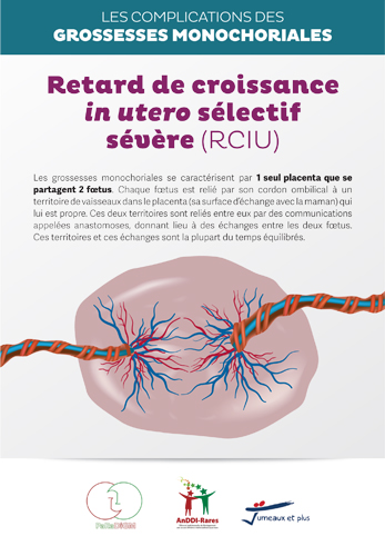 Retard de croissance in utero sélectif sévère (RCIU)