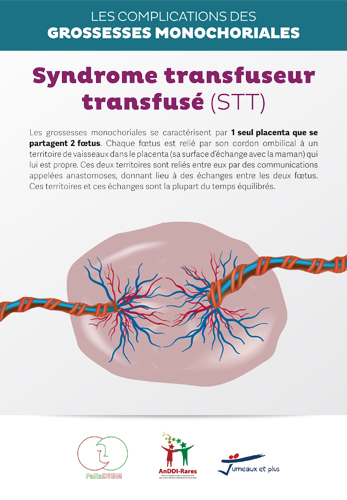 Syndrome transfuseur transfusé (STT)