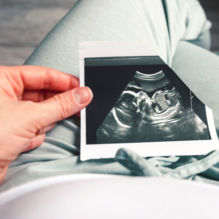 Le Centre de Référence Maladies Rares PaRaDiGM est un réseau spécialisé dans la prise en charge des complications des grossesses multiples liées au placenta monochorial.